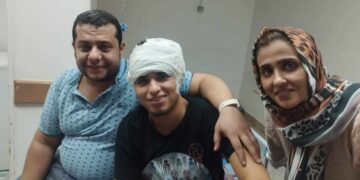 دكتور بيتر عوني يجري عمليه نزيف مزمن تحت الام الجافيه نتيجه حادث لشاب ليبي ف مصر